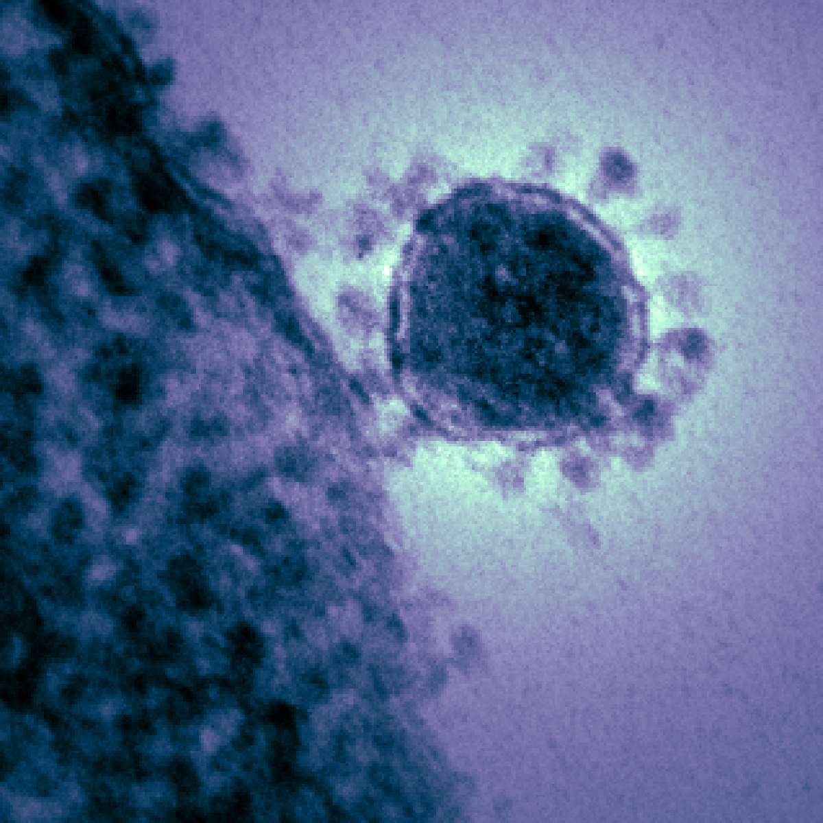 Middle_East_respiratory_syndrome-related_coronavirus